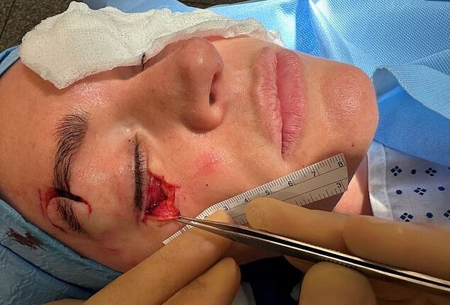 TNT Sports presenter Laura Woods has opened up on the horrific eye injury she suffered on a romantic getaway with her fiancée Adam Collard in 2024