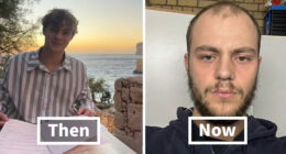 67 People Get Vulnerable By Sharing How They’ve Glowed Down Since They ‘Peaked’