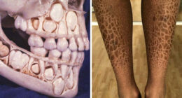 80 Fascinating And Unnerving Medical Pics You May Need A Moment To Process