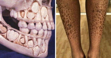 80 Fascinating And Unnerving Medical Pics You May Need A Moment To Process