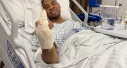 BBC presenter Reggie Yates has revealed he has suffered a cancer scare after undergoing surgery to remove a tumour from his hand