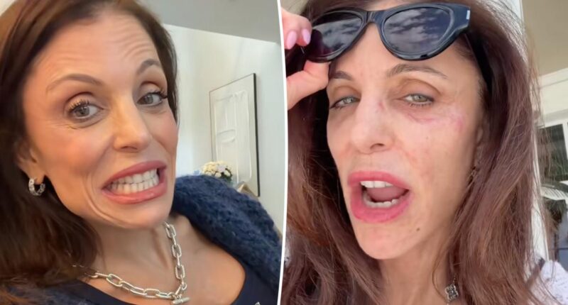 Bethenny Frankel blames a common hotel item for facial bacterial infection