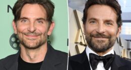 Bradley Cooper addresses plastic surgery rumors