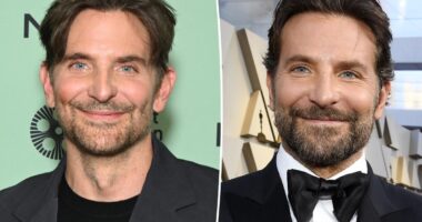 Bradley Cooper addresses plastic surgery rumors