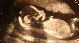 Britain Hits 300,000 Annual Abortions.