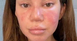 Maren Morris revealed she was fighting the 'worst sinus infection' of her life days before taking to the stage at Dick Clark¿s New Year¿s Rockin' Eve with Ryan Seacrest 2026