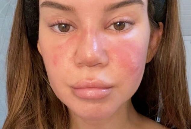 Maren Morris revealed she was fighting the 'worst sinus infection' of her life days before taking to the stage at Dick Clark¿s New Year¿s Rockin' Eve with Ryan Seacrest 2026