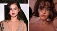 Fans Blame Plastic Surgery For Selena Gomez’s “Unhinged” Transformation In Recent Snaps