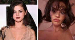 Fans Blame Plastic Surgery For Selena Gomez’s “Unhinged” Transformation In Recent Snaps