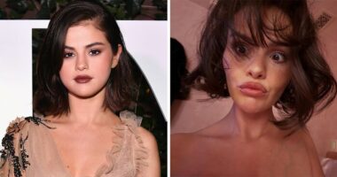 Fans Blame Plastic Surgery For Selena Gomez’s “Unhinged” Transformation In Recent Snaps