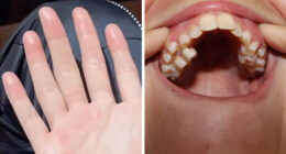 “He was Severely Bullied”: 83 Rare Physiological Traits That Most People Will Never See In Person