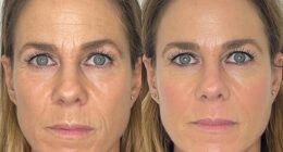 Laura Gee's before and after pictures. 'One morning I looked in the mirror and thought, "Oh hello, that is the face I have missed",' she writes