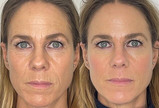 Laura Gee's before and after pictures. 'One morning I looked in the mirror and thought, "Oh hello, that is the face I have missed",' she writes