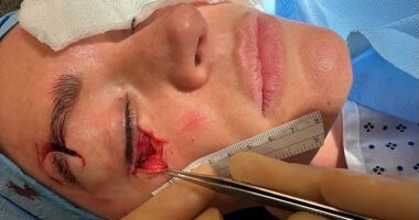 TNT Sports presenter Laura Woodshas opened up on the horrific eye injury she suffered on a romantic getaway with her fiancée Adam Collardin 2024