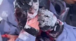 The tourist was helped away clutching her face, which was pouring with blood after the attack