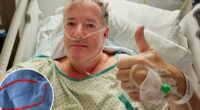 Piers Morgan, 60, hospitalized, will undergo hip replacement