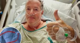 Piers Morgan, 60, hospitalized, will undergo hip replacement