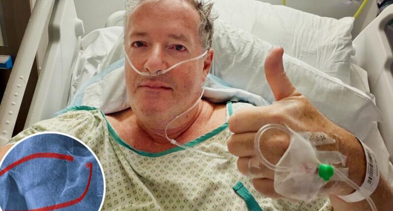 Piers Morgan, 60, hospitalized, will undergo hip replacement