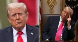 “That’s Why His Face Is Droopy”: Trump Tries To Shut Down Health Speculation As Doctor Raises Concerns