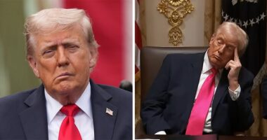 “That’s Why His Face Is Droopy”: Trump Tries To Shut Down Health Speculation As Doctor Raises Concerns