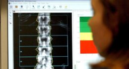The quick spine check that could reduce pain for millions of people later in life