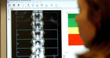 The quick spine check that could reduce pain for millions of people later in life