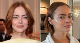 “This Is Not Filler, This Is Not Botox”: Celeb Facialist Reveals Secrets Behind Golden Globes Glow