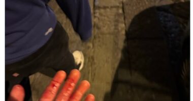 One Chelsea fan posted this image of his blood-soaked hand and said he'd been stabbed