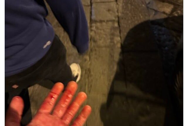 One Chelsea fan posted this image of his blood-soaked hand and said he'd been stabbed