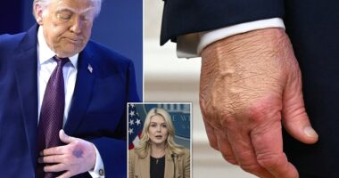 The White House has a new reason for why Donald Trump's hands are consistently bruised. The President's Press Secretary, Karoline Leavitt, told CBS News that Trump 'hit his hand' on the corner of the signing table at the Board of Peace event on Thursday in Davos, Switzerland, 'causing it to bruise.' The noticeable contusion was seen on Trump's left hand, which is not the one normally covered with makeup to conceal the discoloration of a bruise. Previously, Leavitt has said that Trump's right hand is chronically bruised because of the frequency in which he shakes people's hands.