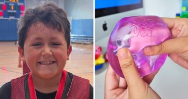 9-Year-Old Suffers Severe Facial Burns After Dangerous TikTok Trend Goes Horribly Wrong