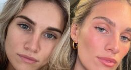 Paige Dubrul, better known as 'Injector Paige' to her devoted Instagram followers, specializes in getting natural results by facial balancing using Botox and filler