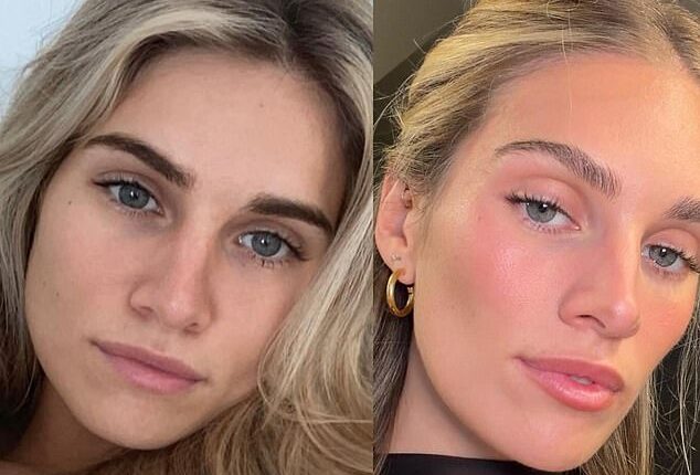 Paige Dubrul, better known as 'Injector Paige' to her devoted Instagram followers, specializes in getting natural results by facial balancing using Botox and filler
