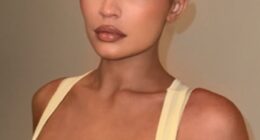 She's been outspoken on her lip filler journey in recent years - but Kylie Jenner appears to have turned her back on the procedure in recent times (pictured before)