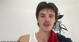 Cruz Beckham has shared a behind-the-scenes look at his latest song as he sported bandages after chopping his pinky finger off