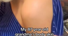 A US emergency room doctor has delivered a stark reminder about the true cause of ageing skin. It comes after he reshared a video of an 87-year-old grandmother whose remarkably youthful appearance has stunned millions online (pictured)