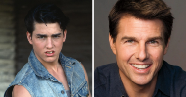 From Gaps To Glam: 12 Celebrity Dental Implant Makeovers You Won’t Believe