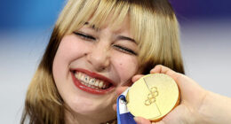 Health Experts Sound Alarm For Fans Eager To Copy Olympic Star Alysa Liu’s ‘Viral’ Look