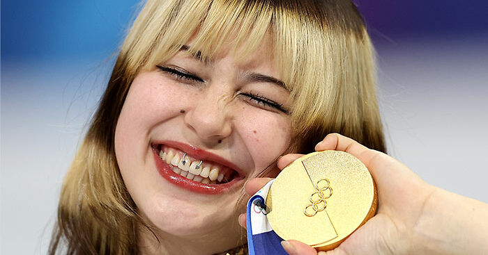 Health Experts Sound Alarm For Fans Eager To Copy Olympic Star Alysa Liu’s ‘Viral’ Look