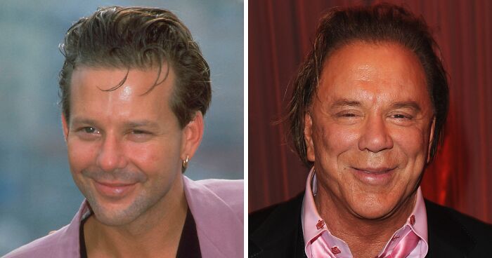 How Mickey Rourke Would Look Today Without His Dramatic Cosmetic Procedures
