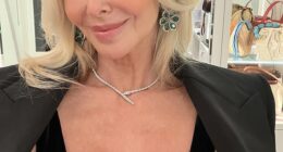 Amanda, who credits her new glow-up - including going under the knife - with giving her the confidence to put herself out there again, insists that cosmetic procedures are about being the best version of yourse