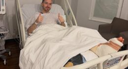 Jack Grealish has confirmed his season is over after he underwent surgery on a stress fracture of his foot