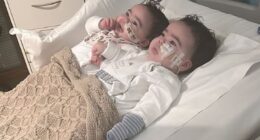 Jesy Nelson has shared a sweet photo of her baby twins holding hands and watching TV in hospital amid their devastating spinal muscular atrophy (SMA) type 1 diagnosis