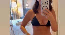 Lucy Mecklenburgh has revealed what her scars look like after undergoing laparoscopy surgery for endometriosis in November