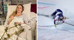 Major Update On Olympian Lindsey Vonn After Horrific Crash That May Cost Her A Leg