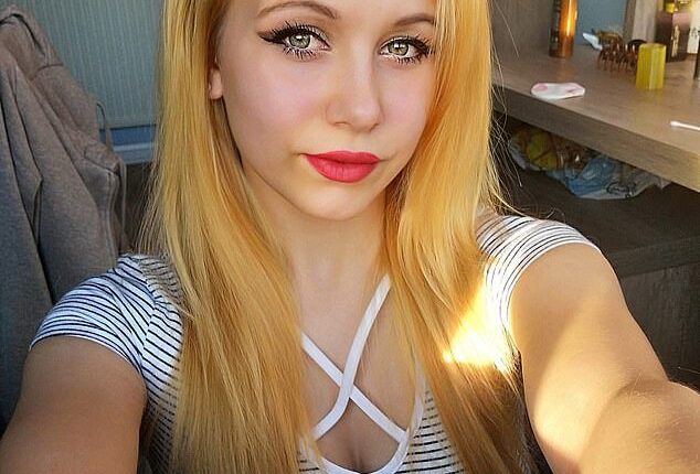 Former factory worker Anna Rachfal, 29, who lives in Coventry, had her hair ripped out in a horrific workplace accident