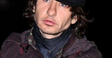 The Irish actor, 33, showed off a much fuller pout as he posed for photos in front of the Tower Bridge in London before Burberry's quintessentially British presentation