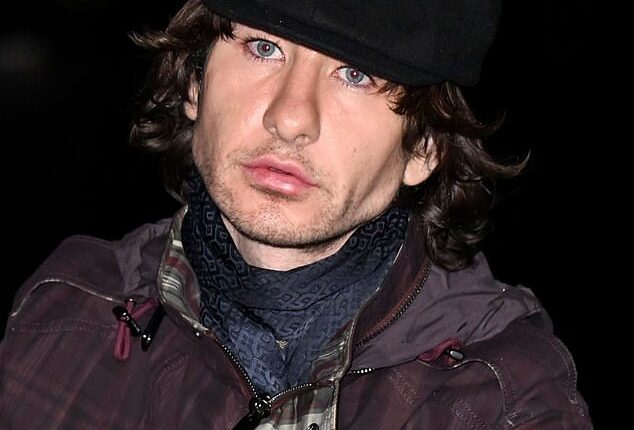 The Irish actor, 33, showed off a much fuller pout as he posed for photos in front of the Tower Bridge in London before Burberry's quintessentially British presentation