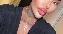 Jordan James Parke, who underwent cosmetic surgery more than 50 times and shot to fame on reality TV show Botched, passed away on Wednesday February 18, 2026