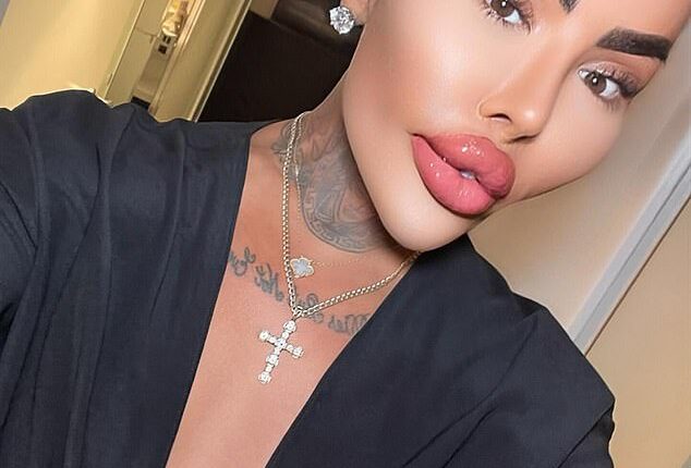 Jordan James Parke, who underwent cosmetic surgery more than 50 times and shot to fame on reality TV show Botched, passed away on Wednesday February 18, 2026